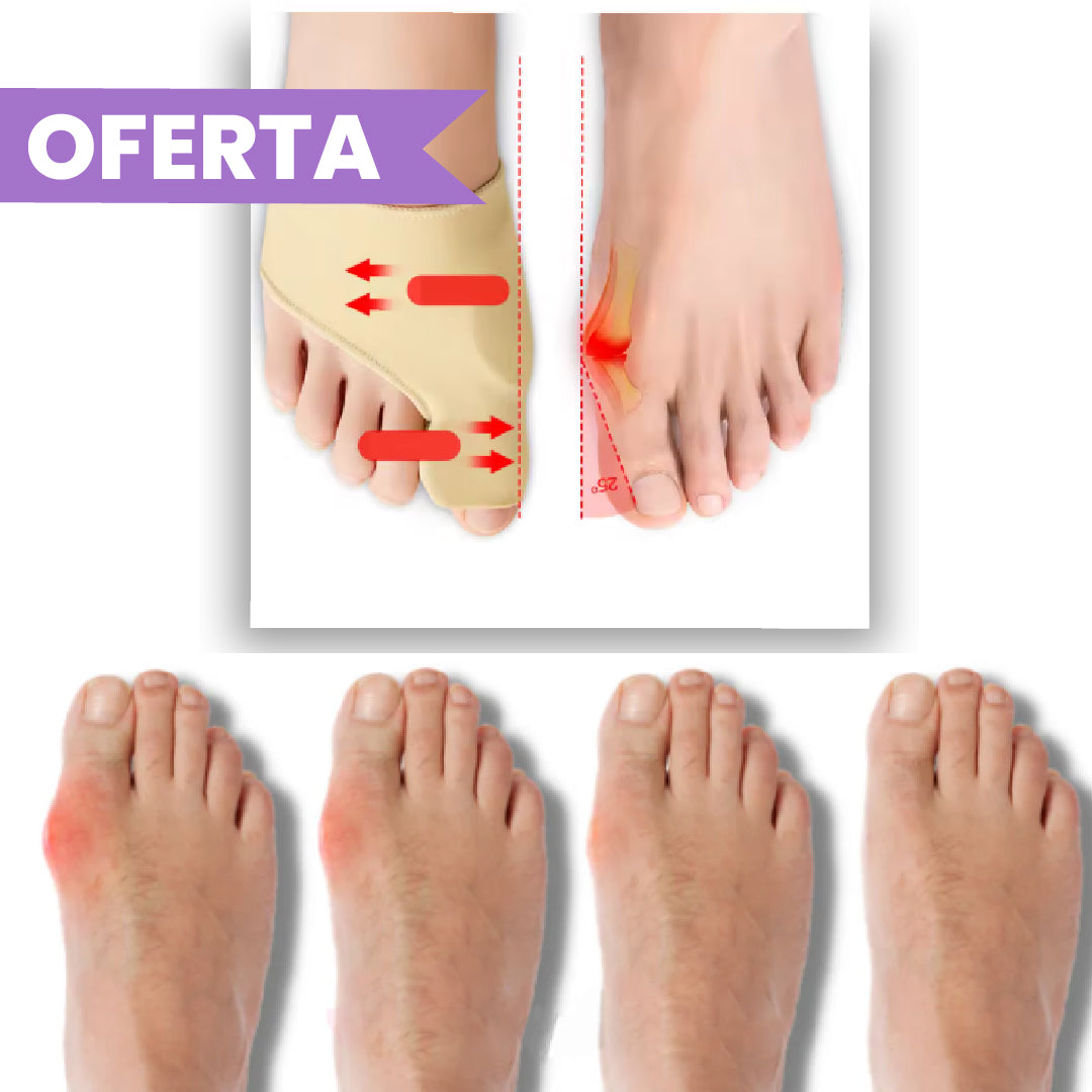 Anti Juanetes con Gel Ortopédico - 1 Par